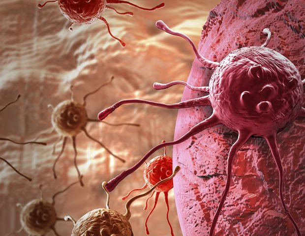 million CPRIT grant focuses on AI to improve prostate cancer outcomes  million CPRIT grant focuses on AI to improve prostate cancer outcomes