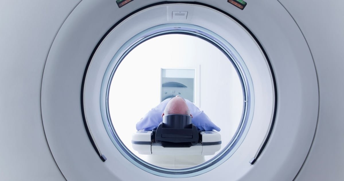 National rapid stroke imaging AI study underway in New Zealand