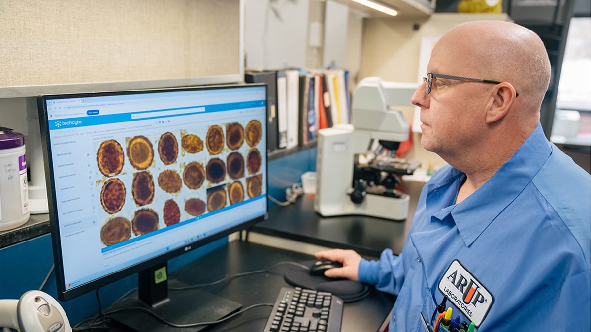 AI excels at detecting parasites in stool samples, study finds – @theU