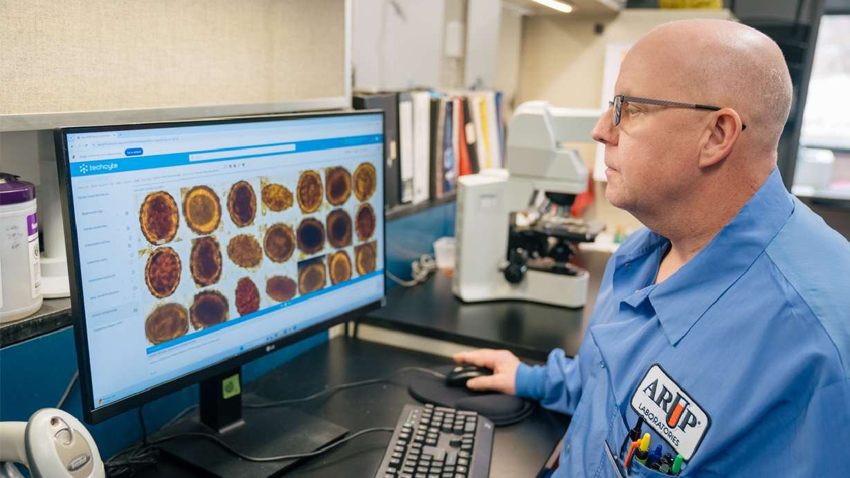 Utah study shows AI can quickly and accurately detect parasites in stool samples Utah study shows AI can quickly and accurately detect parasites in stool samples